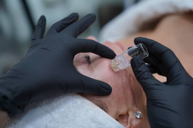 AquaGold facial