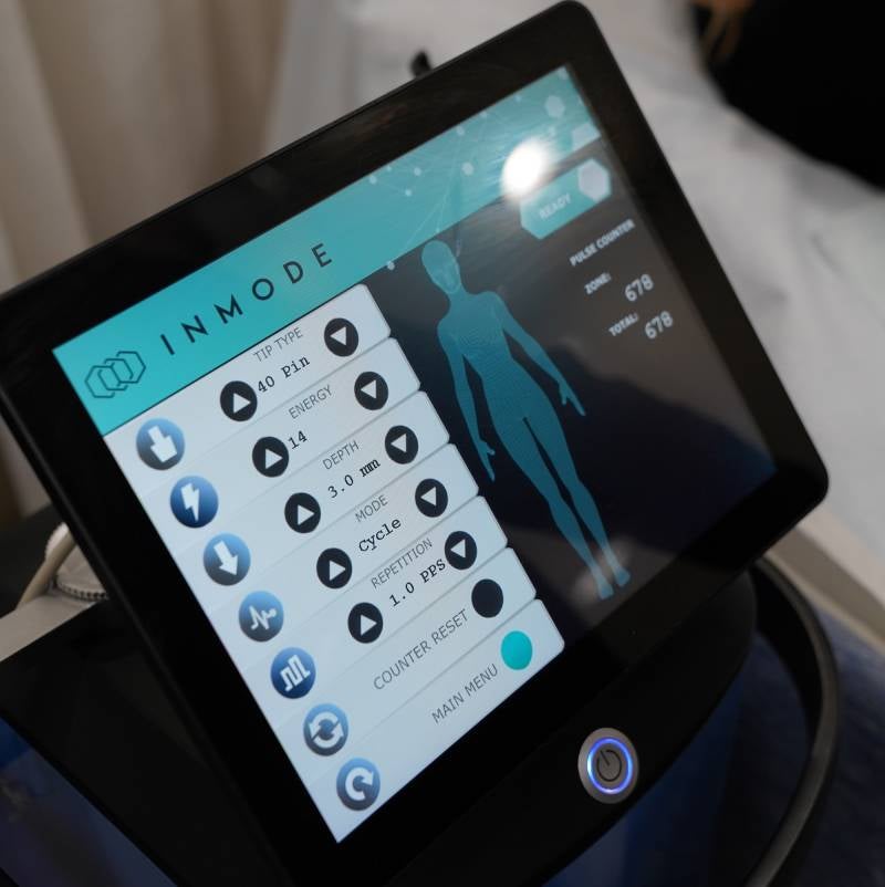InMode treatment