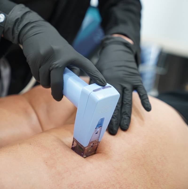 Can I Combine Other Facial Rejuvenation Treatments With Morpheus8?