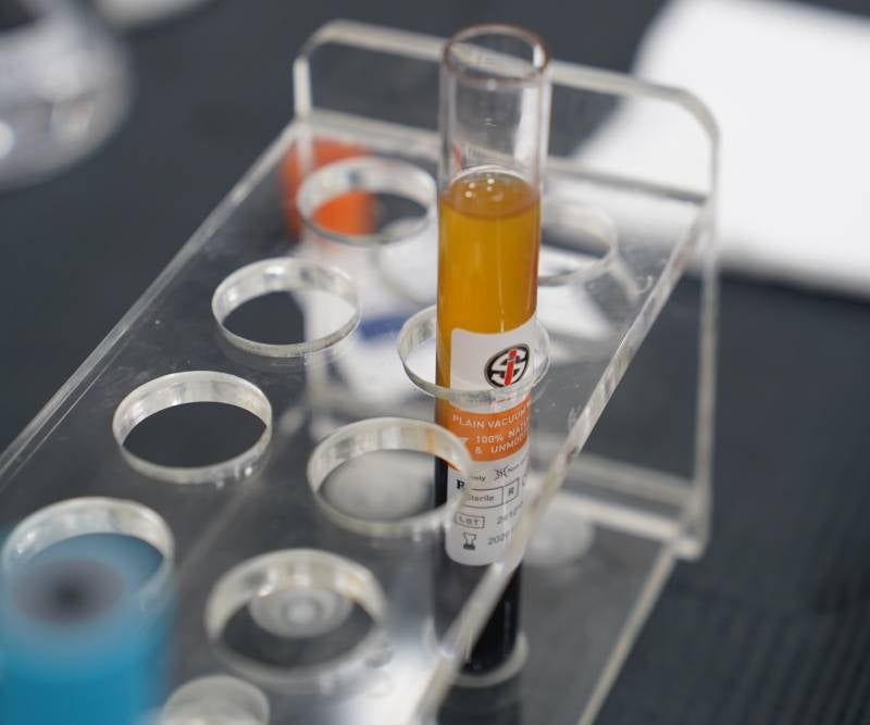 PRP Treatment