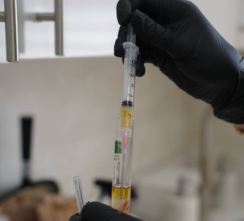 PRP and PRF treatments injection