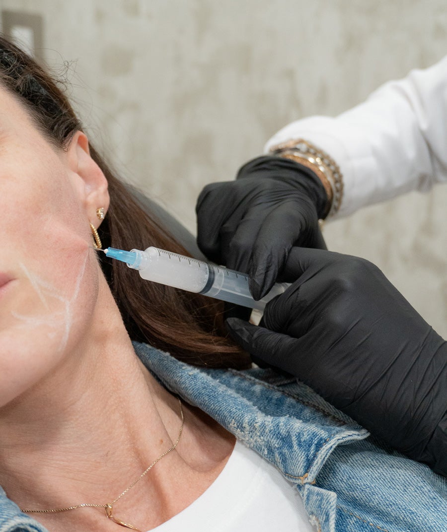 Close-up of a person receiving a cosmetic injection in their cheek, with white lines marked on their skin.