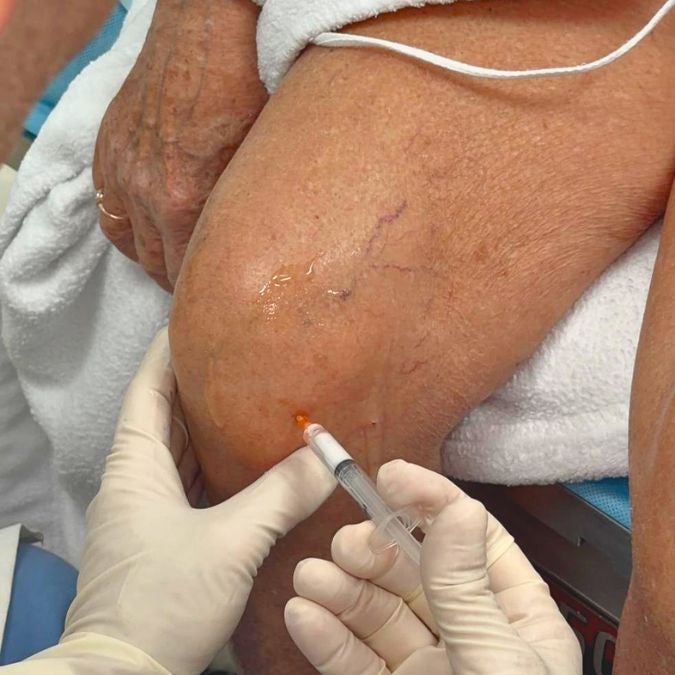A person's leg being massaged