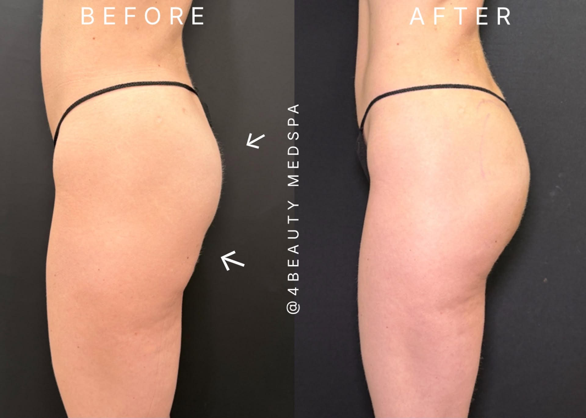 Before and after results