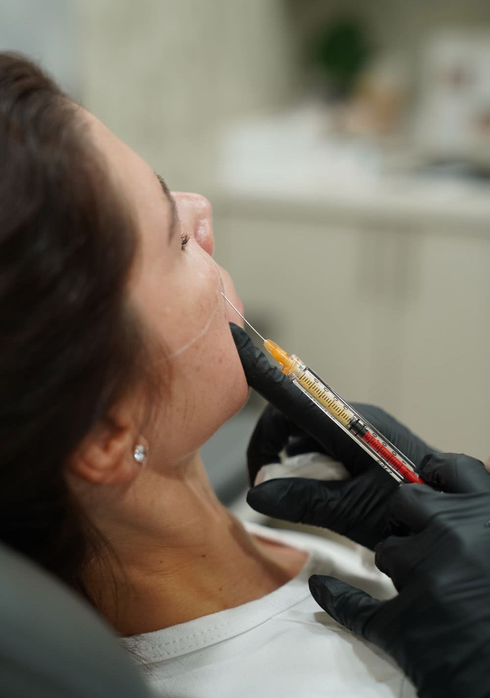 Close-up of a person receiving an injection in their marked jawline from a gloved hand.