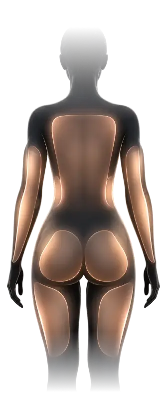 Treatment areas on the back of the body