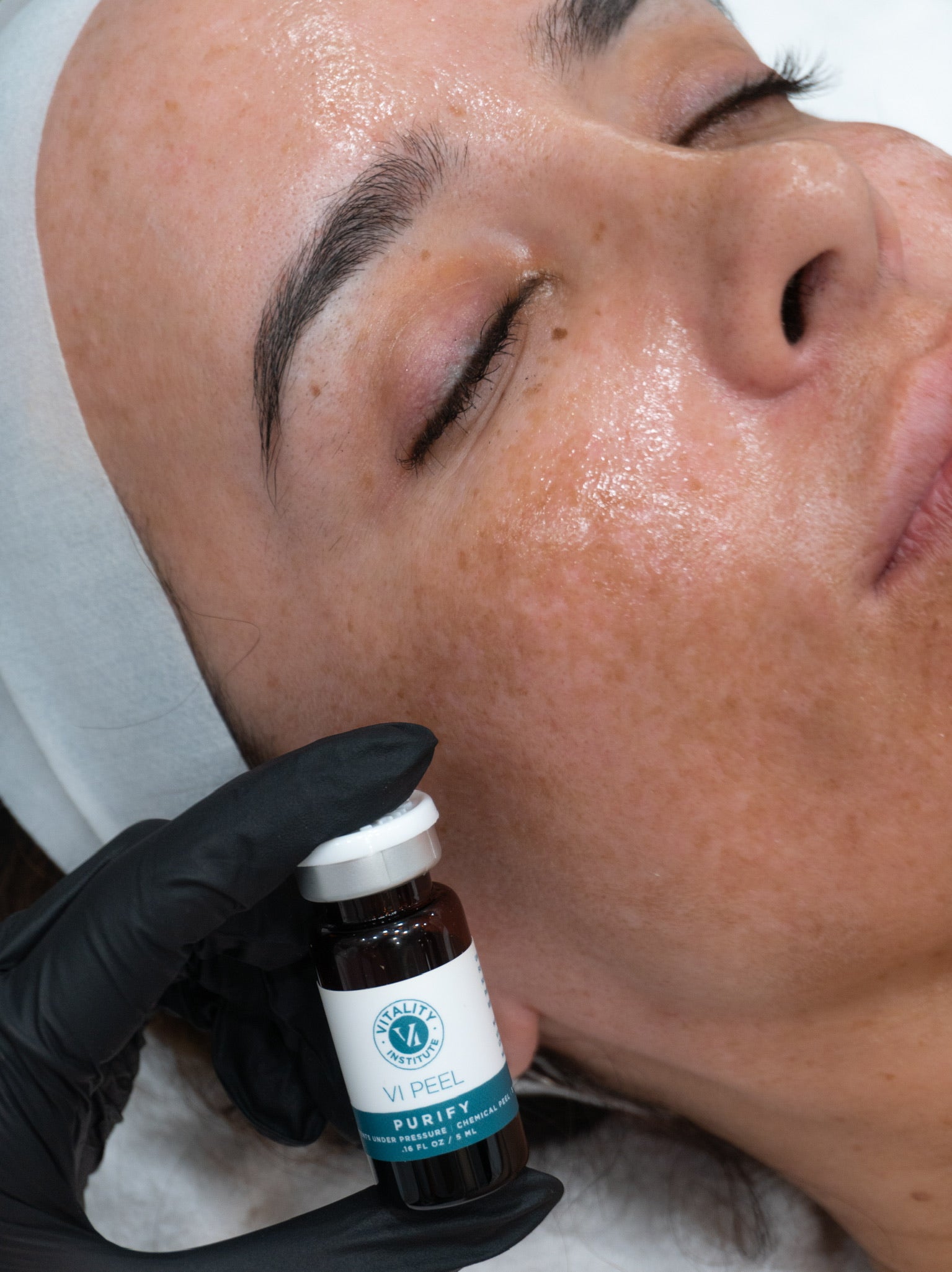 Close-up of a person's moisturized face with freckles, while a gloved hand holds a VI Peel Purify bottle.