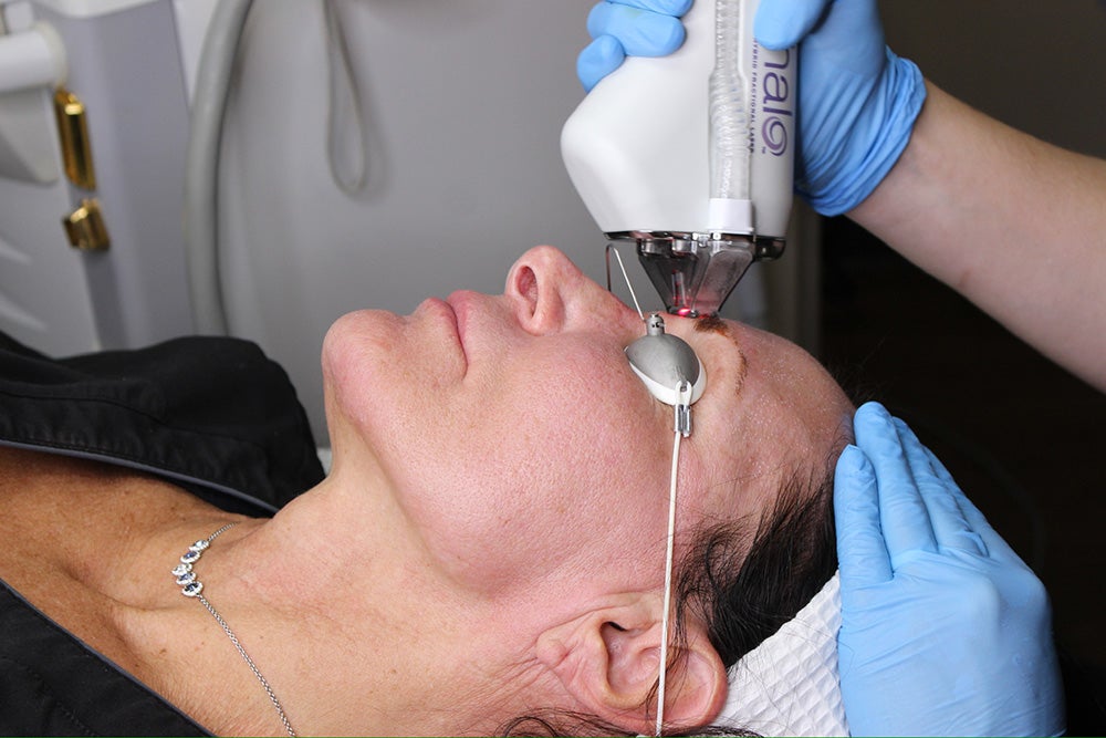 Laser Treatments