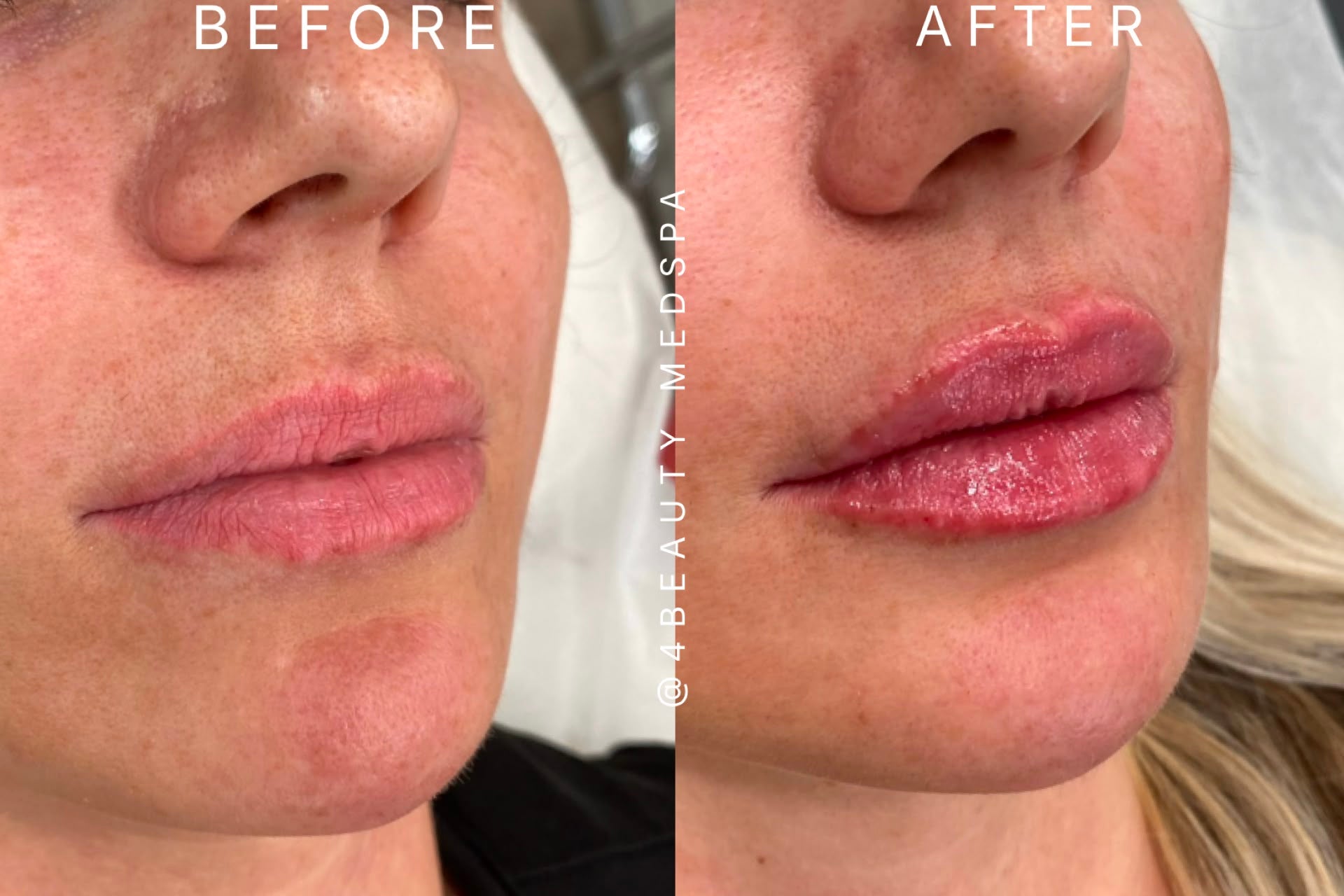 Beautiful woman with full lips