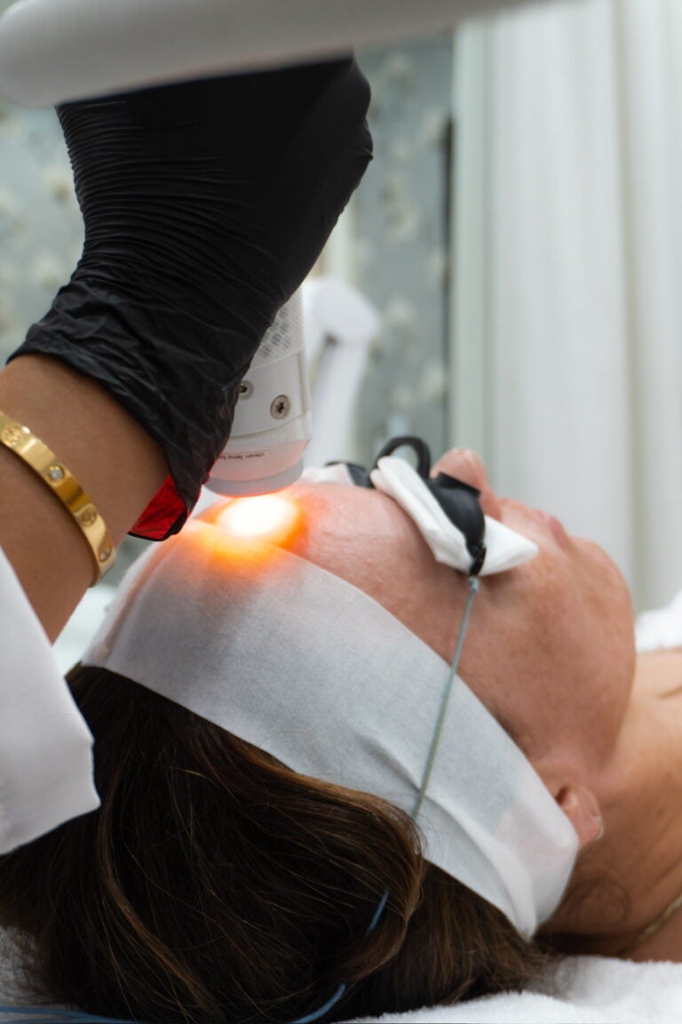 close up of a woman getting a laser treatment