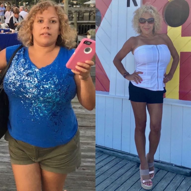 How Long Is a Medical Weight Loss Program?
