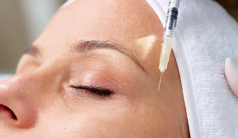 Close-up of a person's closed eye and eyebrow as a syringe injects liquid into the skin near the eyebrow.
